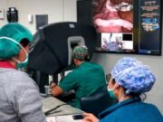 Navegació quirúrgica: el sistema tipus GPS que revoluciona les operacions