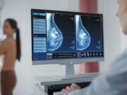 Fundació ECO i Novartis avalen un model assistencial centrat en la pacient